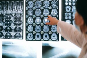 Afecțiuni neurologice